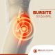 Bursite no Quadril